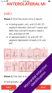 ECG FlashCards 2 Lite - Free Reference EKG App screenshot 10