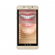 Teeth Whitening Tips: How to Remove Teeth Stains screenshot 2