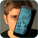 Skull X-ray Prank