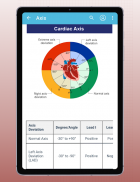 ECG EKG Interpretation Mastery screenshot 3