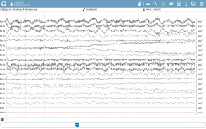 NeuroCenter EEG screenshot 0