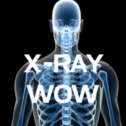 X-RAY WOW screenshot 14