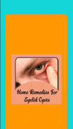 Remedies For Eyelid Cysts screenshot 5