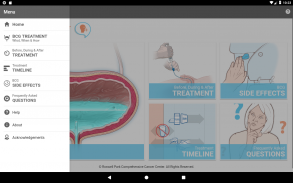 BCG Treatment screenshot 2