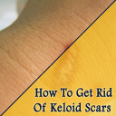 How To Get Rid Of Keloid Scars Icon