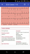 Basic ECG Guide screenshot 1