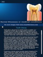 Dental Anatomy Pro. screenshot 10