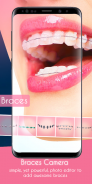 Braces Camera Photo Editor screenshot 4