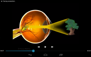 Ophthalmology -Pocket Dict. screenshot 1