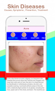 All Skin Diseases and Treatment screenshot 2
