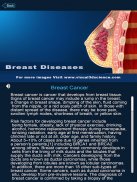 Breast Anatomy Pro. screenshot 8