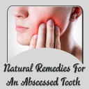 Natural Remedies for Abscessed Tooth