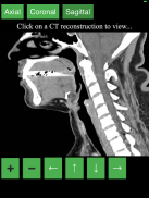 CT Neck screenshot 1