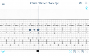 Cardiac Device Challenge screenshot 6