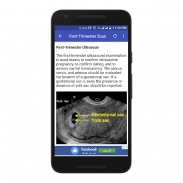 Obstetrics & Gyenacology Ultrasound Guide screenshot 2