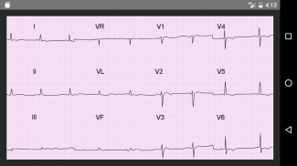 ECG 100 Clinical Cases screenshot 1