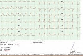 Mobile ecg recording screenshot 3