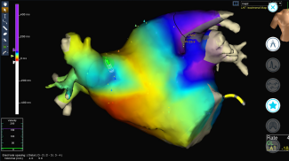 Cardiac Arrhythmia Challenge screenshot 12