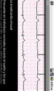 Electrocardiograma ECG Tipos screenshot 5