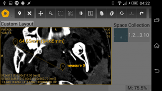 Symmetry DICOM screenshot 13