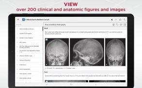 5-Minute Sports Medicine Consult screenshot 8