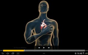 Cardiology-Animated Dictionary screenshot 1