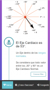 Calculadora de Eje Cardiaco ⚕️ screenshot 0