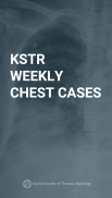 KSTR Weekly Chest Cases screenshot 3