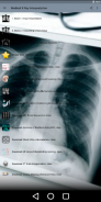 Medical X-Ray Interpretation with 100+ Cases screenshot 2