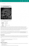 The brain screenshot 6