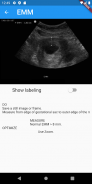 UM Ultrasound App screenshot 0