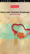 Polycystic Ovarian Syndrome screenshot 0