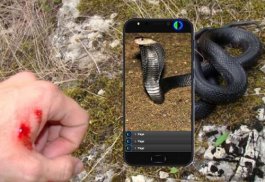 Tips for handling poisonous snake bites screenshot 2
