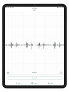 Eko: Digital Stethoscopes screenshot 5