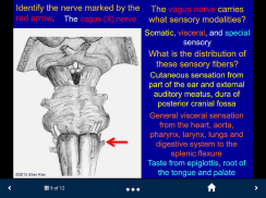 Neuroanatomy - SecondLook screenshot 0