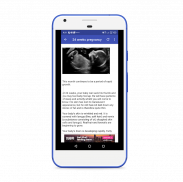 Ultrasound pregnancy guide screenshot 9