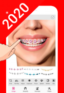 Braces Camera 2020 : Best  Braces  Editor of 2020 screenshot 2