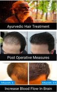 Hair loss and treatment( trans screenshot 2