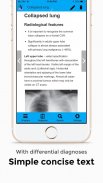 CXR FlashCards - Reference app for Chest X-rays screenshot 1