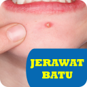 Cara Mengobati Jerawat Batu