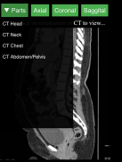 Radiology CT Viewer screenshot 8