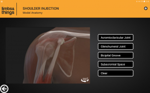 Guided Shoulder Injection screenshot 0