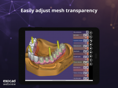 exocad webview - Kostenloser 3D STL OBJ Viewer screenshot 1