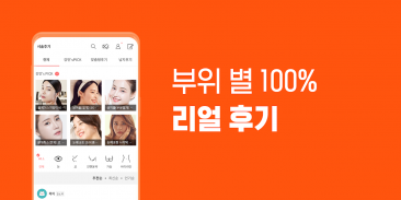 강남언니 - 성형정보 &시술후기 screenshot 1