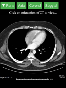Radiology CT Viewer screenshot 9