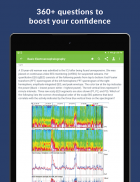 Epilepsy Board Review Q&A screenshot 4