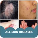 Skin diseases and treatment Icon