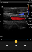 Philips Lumify Ultrasound App screenshot 2