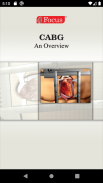 Coronary Artery Bypass Graft screenshot 5