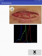 APD Skin Monitoring App screenshot 9
